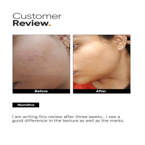 Minimalist 32% AHA PHA BHA Peel for Instant Glow & Soft Skin 30ml (India)