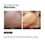 Minimalist 32% AHA PHA BHA Peel for Instant Glow & Soft Skin 30ml (India)