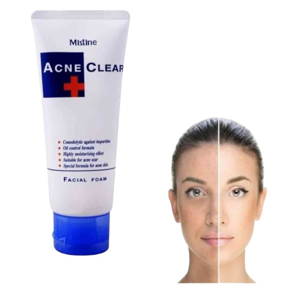 Acne Clear Plus Face Wash