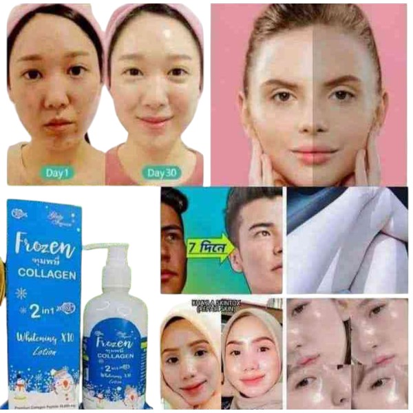 Frozen Collagen 2in1 Whitening Lotion