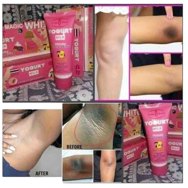 Yogurt milk whitening underarm cream