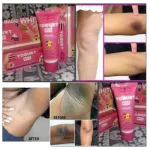 Yogurt milk whitening underarm cream