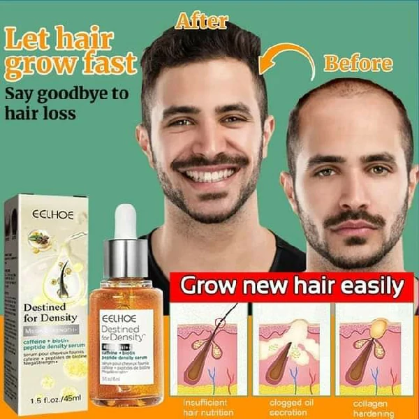 Eelhoe Hair Growth