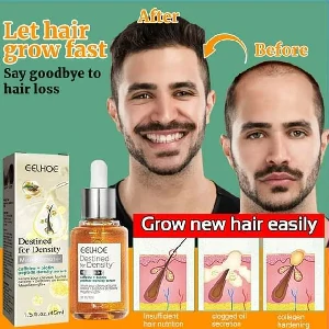 Eelhoe Hair Growth