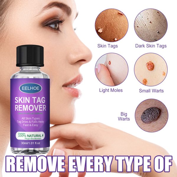 Achill Remover Serum 10ML