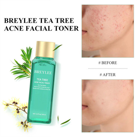 Breylee Tea Tree Acne Facial Toner 100ml (China)