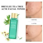 Breylee Tea Tree Acne Facial Toner 100ml (China)